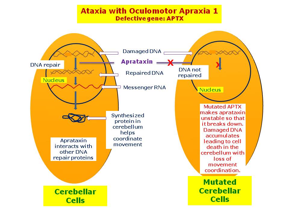 Ataxia with oculomotor apraxia 1 hereditary ocular diseases
